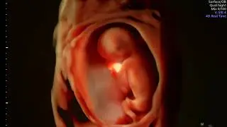 14 Weeks Ultra-High Definition 3D/4D Ultrasound