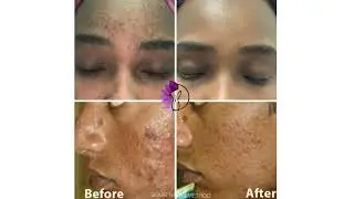 What Happens to Black Women When She Doesn't Remove Makeup?