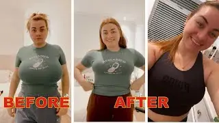Woman spends her inheritance money to carry out reduction surgery on her 34HH breasts (photos)