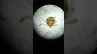 PSOROPTES Mites were seen under microscope 🔬