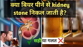 क्या Beer पीने से Kidney Stone निकल जाती है? सच्चाई जानिए !