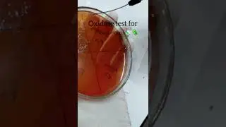 oxidase positive bacteria🦠 pseudomonas #microbiology #bacteria #oxidase test #shorts