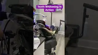 Short clip of our in office teeth whitening