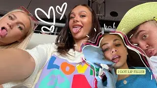 I got lip filler and went to see Harry Styles the next day