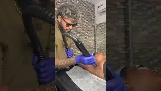 ￼￼ # carbon Laser Treatment # Pradeep Skin care # Chennai Kundrathur cell ￼9710211259