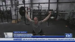 Dr. Campbell: Diet, exercise can make difference in survival after colon cancer