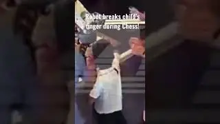 Robot breaks a boys finger!