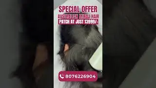 Australian Hair Patch Just ₹13,999/- 😱 #shorts #youtubeshorts #hairpatch