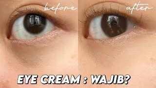 Eye Cream : Buang2 Uang? + Rekomendasi Untuk Mata Panda