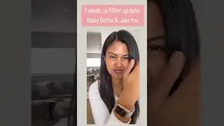Katrina Dimaranan Botox Update | O Skin Med Spa