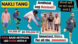 🤯🤯Best Artificial Limbs Clinic in India | Prosthetic Leg Clinic | #artificiallimb #ottobock #ossur