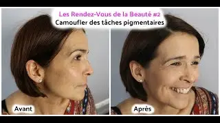 Les Rendez-Vous de la Beauté #2: Camoufler ses tâches pigmentaires