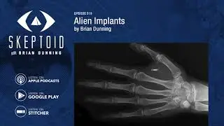 Alien Implants