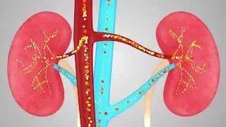 Transforming Veterinary Education: Watch Our 3D Animation on Kidney Failure in Pets!