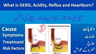 What is GERD, Acidity, Reflux and Heartburn? Part 2 | Causes, Symptoms, Treatment and Risk Factors