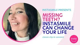 Getting your confidence back with instasmile! Review of instasmile Classic Veneers for missing teeth