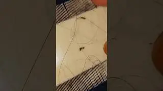 Female Louse part1 🎀#shortsvideos #shorts #yt #ytviral #viral #new #foryou #fypシ゚viral #ytnew