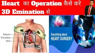 Heart का Operation कैसे करे / 3D Emination से / everything about heart surgery #heart ❤❤