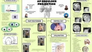 IMAGING TECHNIQUE VIDEO SUBMISSION (AP SHOULDER PROJECTION)