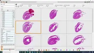 Integrated Quantitative Pathology in Patholytix AI