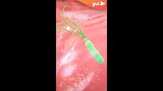 Что такое гастрит и H. Pylori? | 3D #Shorts
