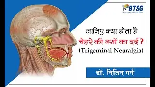 जानिए क्या होता है चेहरे की नस का दर्द(Trigeminal Neuralgia) डॉक्टर नितिन गर्ग से |