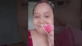 একটা লোশন গায়ে মাখলাম। আমার কি কষ্ট 🥴🥴