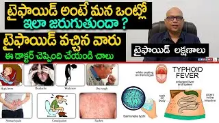 Typhoid Fever Symptoms , Cause, Treatment, Tests, Diet | Doctors Advice |  Eagle Media Works
