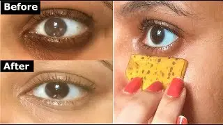 Rub Banana Peel around Eyes Daily to remove Dark Circles, Under Eye bags, puffyeyes and eye wrinkles