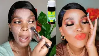 Is Calamine Lotion The Most Affordable Face Primer in the market?Oily Skin|TheFix||MadPrice Clothing