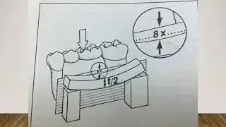 2'' Bridge design part II '' Biomechanical Consideration