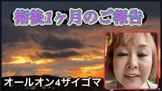 【歯医者難民】オールオン4ザイゴマの手術を受けて1ヶ月後の様子。#福岡県#仮歯#術後#歯医者難民