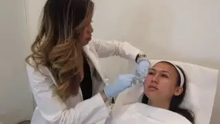 MicroNeedling Treatment