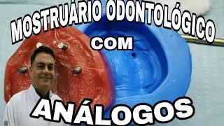 MOSTRUÁRIO ODONTOLÓGICO - 2º PREPARANDO MODELO EDÊNTULO COM ANÁLOGOS (IMPLANTE) PARA DENTO GENGIVAL.