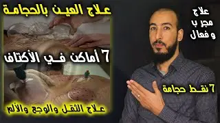 علاج العين بالحجامة وبالتركيز على حجامة 7 أماكن في الأكتاف لإخراج العين المعقودة والتي تسبب الثقل..