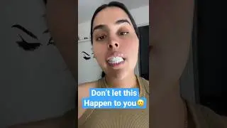 PLEASE! Be careful with your implants (CALL US) #ytshorts #shortvideo #disaster #help