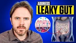 Understanding Leaky Gut Symptoms and Solutions with Dr. Justin Marchegiani || Top 5 Ways to Heal