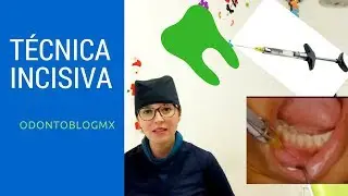 Técnica de anestesia Incisiva