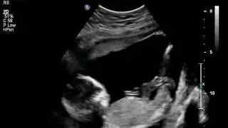 Baby Girl 2-23-2012 Kick!