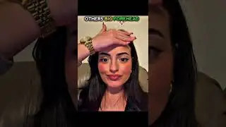 Others Big Forehead Vs This Girl☠️! #edit #shorts #trollface