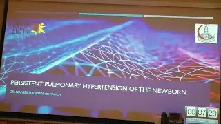 Persistent Pulmonary Hypertension of the Newborn Dr Nanes Soliman, MD, MRCPCH
