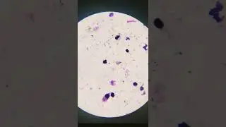 Under a microscope image of a Leishmania amastigote