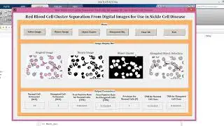 MATLAB code of Sickle Cell detection from Blood images