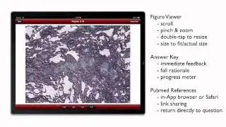 ACCP-SEEK and ACCP-SEEK CME Board Review Apps