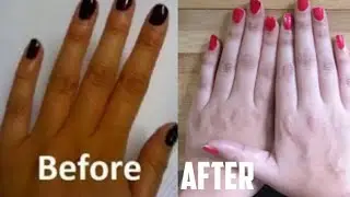 How To Get Fair Hands and Arms at Home | Hand Whitening At home In 1 Week |Remove tan from hands