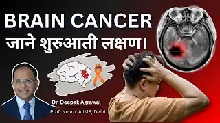 Brain Cancer (दिमाग का कैंसर) Symptoms, Types & Treatment | AIIMS Delhi Neurosurgeon Explains