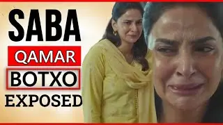 Botox Controversy: Doctor Breaks Down Saba Qamar's Pamaal Emotional Scene 💔