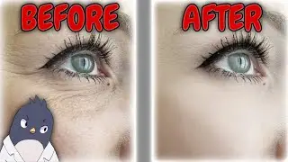 Is Astaxanthin Good For Wrinkles & Sun Protection?