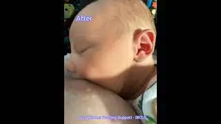 Breastfeeding latch adjustments
