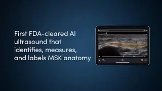 Introducing Clarius MSK AI